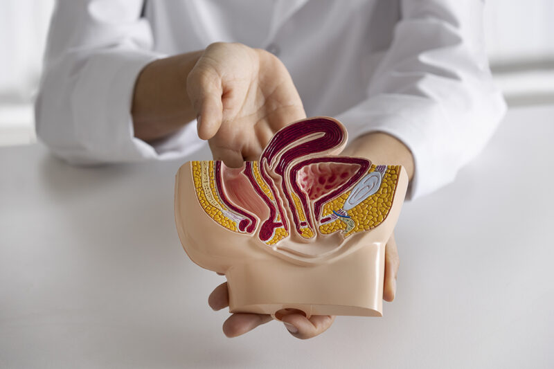 Incontinenta urinara de efort​